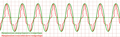 sinus